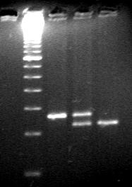 Detección de G20210A Gradiente Ficoll Extracción DNA PCR Digestión Electroforesis en gel Células serie blanca protrombina Hind III