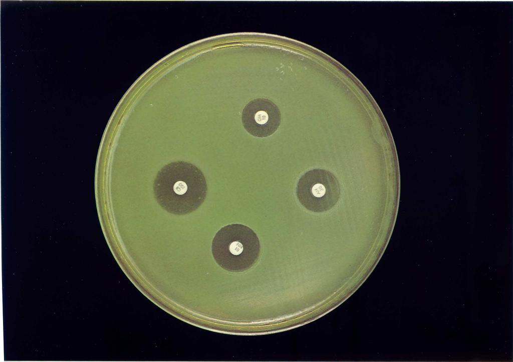 La adquisición de resistencia a un antibiótico antibacteriano en el transcurso de una infección no es sino un ejemplo de la rápida capacidad de adaptación de las poblaciones bacterianas a los cambios