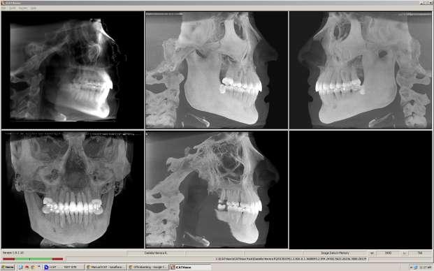 Pantalla Ortodóncica: La pantalla de ortodoncia muestra las imágenes