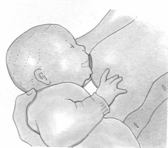 - Se debe evitar que el bebé quede demasiado apretado sobre el pecho de la madre, ya que el seno taparía la nariz del bebé y no lo dejaría respirar bien, lo que ocasionaría que éste soltara el pezón