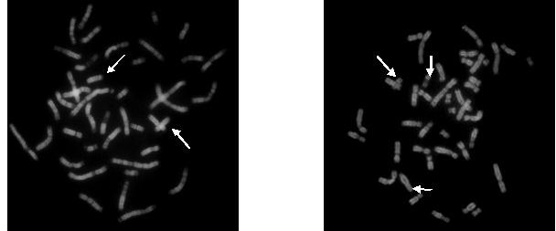 A1 y A2: Morfotipo A con manto sin banda negra en el dorso. B: Morfotipo B, ejemplar con banda negra en el dorso. A B Figura 2. Metafases en Bandeo Q de dos ejemplares de la ardilla colombiana. A. Metafase del morfotipo A mostrando el par cromosómico 16 acrocéntrico que lo caracteriza.