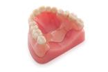 Sin retenedores metálicos Se mimetizan con dientes y encías BENEFICIOS Estéticas libres de metal.