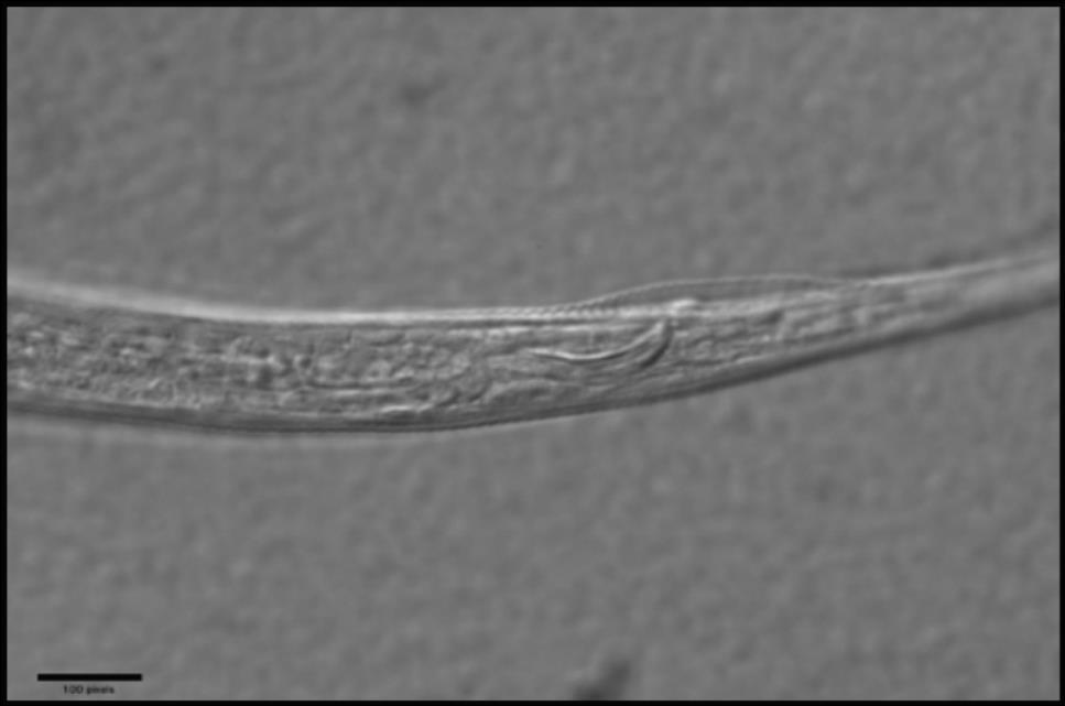 7.7. Ditylenchus sp. 12 µm Figura 16: Fotografía de la parte anterior del nemátodo del género Ditylenchus sp. donde se observa el tamaño del estilete.