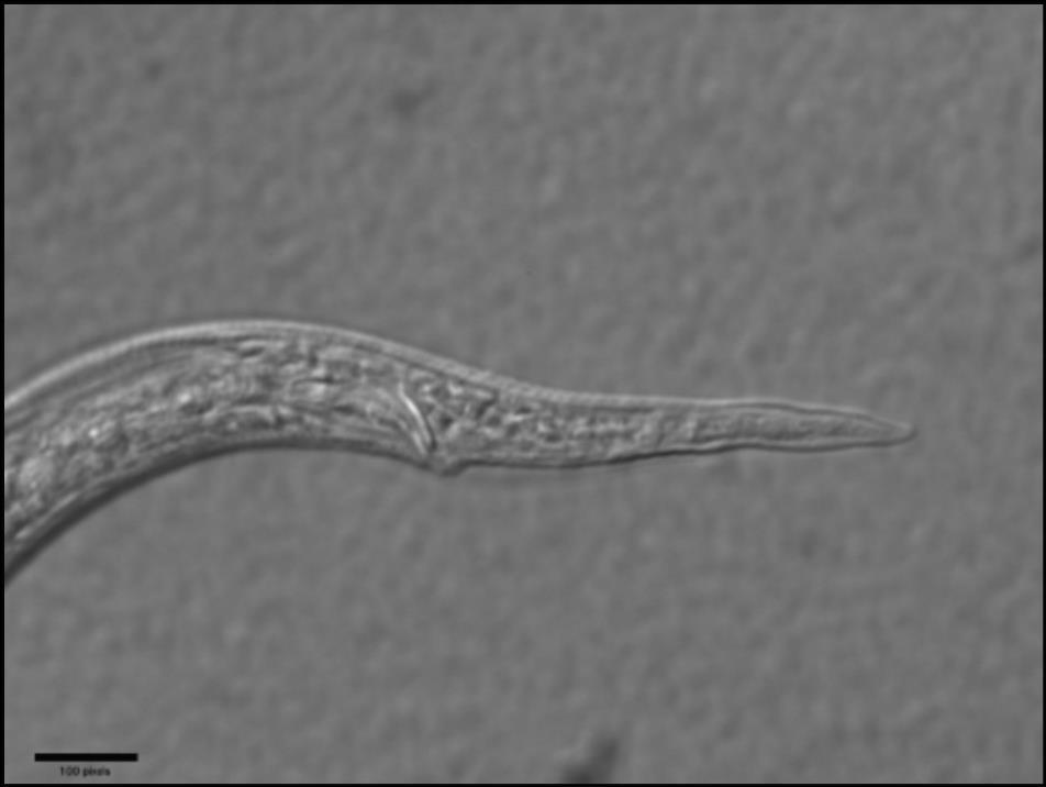 Figura 18: Fotografía de la parte posterior del nemátodo del género Ditylenchus sp. donde se observa la forma de la cola. Tomada con el microscopio de luz. 7.