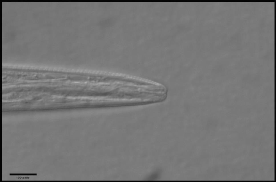 7.15. Boleodorus sp. 10 µm Figura 32: Fotografía de la parte anterior del nemátodo género Boleodorus sp. donde se observa el tamaño del estilete.