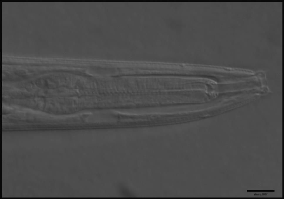 7.18. Mesorhabditis sp. Figura 37: Fotografía de la parte anterior del nemátodo género Mesorhabditis sp. donde se observa el aparato bucal.