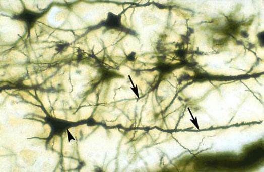 Neuronas: cerebro conectivo: