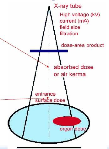 Magnitudes fuera del paciente Dosis absorbida (kerma aire) Energía absorbida por unidad de masa Dosis superficie entrada (kerma aire)