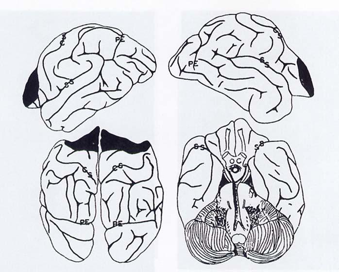 12 Fig.5: Áreas corticales de ablación en los experimentos de Fulton.