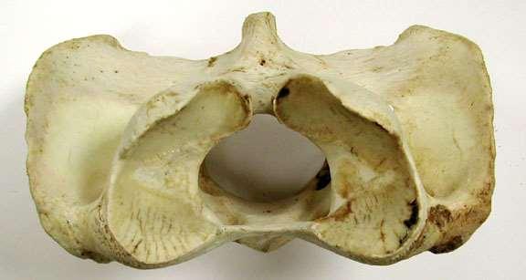 La primera vértebra de la serie cervical En muchos vertebrados presenta una típica morfología alar Cuerpo vertebral reducido.