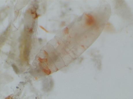 Muestras biológicas El análisis cualitativo del zooplancton recogido en las campañas de estudio demostró la presencia de krill (Meganyctiphanes