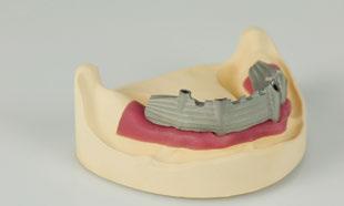 Introduzca el modelo dental en el escáner y siga las instrucciones de escaneado.