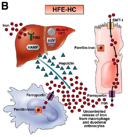 HFE Hemocromatosis C282Y/C282Y à 90% HH Autosómica recesiva Gen penetrancia incompleta à 13,9% desarrolla la enfermedad Caucásicos, sexo masculino.