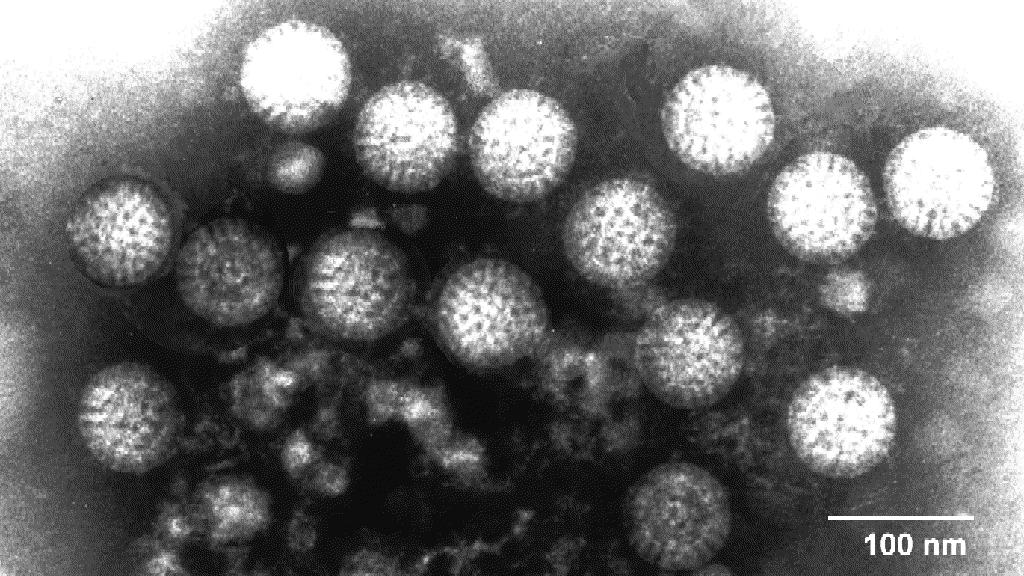 Rotavirus Principal causa de diarrea en el mundo (afectan por igual a países desarrollados y en vía de desarrollo) Mayor incidencia en meses de frío.