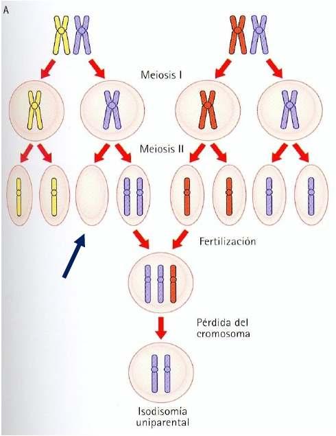 Disomía uniparental Se produce cuando los 2 Cromosomas Homólogos de un par provienen del mismo Progenitor (los dos de origen paterno o de origen materno) Fig.