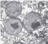 Peroxisomas Organelos pequeños (0,5-1 um), esféricos, rodeados de membrana Cristaloide en su interior: gran concentración proteica Función: Degradar ácidos grasos y moléculas tóxicas (detoxificación)