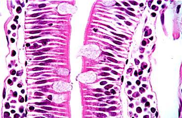 entre las células epiteliales