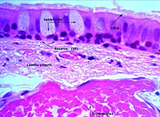 intestinal) Pluricelurares: Intraepiteliales Lámina