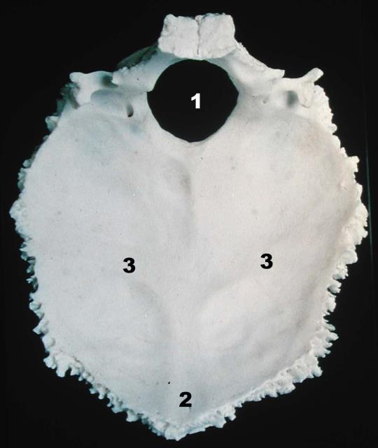 7 posteroinferior, exocraneana, de forma convexa y otra anterosuperior, endocraneana, de forma cóncava; cercano al sector anterior se observa un orificio, el agujero occipital, de aproximadamente 35