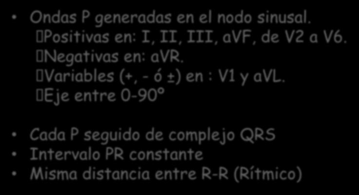 3º Ritmo sinusal Ondas P generadas en el nodo sinusal.