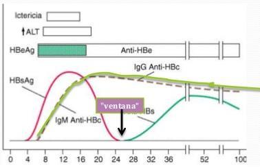 Hepatitis B (VHB) 1. Infección actual HBsAg reactivo Anti-HBc reactivo 2.