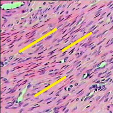 B) Músculo liso tejido formado por células delgadas ahusadas, miofibrillas paralelas al eje mayor, no estriaciones transversales