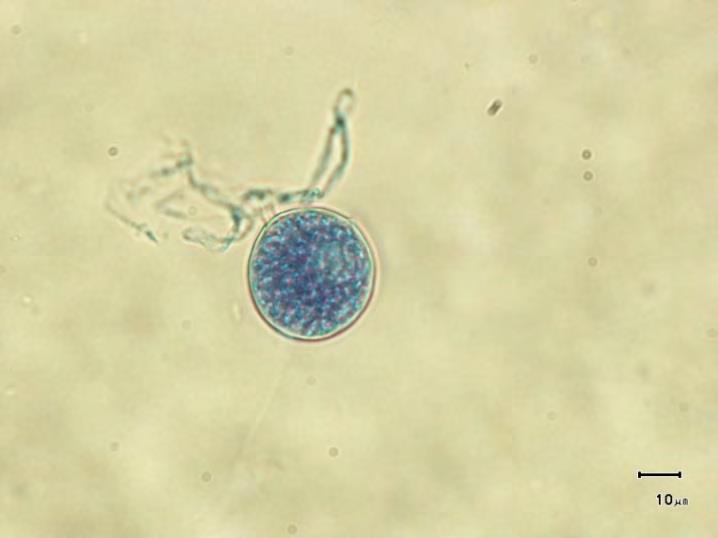 El inóculo de Phytophthora puede ser transportado en el aire, en el agua o en el follaje