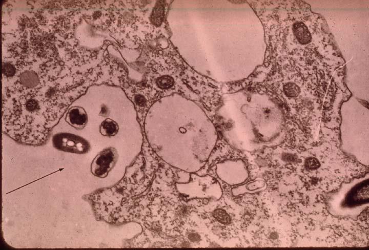 Puede apreciarse un flagelo extendiéndose del Protozoo a la izquierda. Los bultitos son bacterias. (Manual de Biología del Suelo, en línea). Imagen cortesía de: Elaine R.