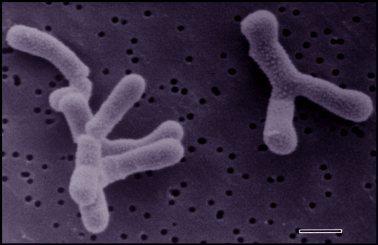Bífidobacterias Bifidobacterium longum puede ser considerada como la más común de las especies de las bifidobacterias, Localizada tanto en heces adultas como en la de niños.