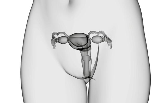 Ovarectomía y salpingectomía Adhesiolisis Cistectomía Aplicaciones en cirugía general y visceral: Colectomía Fundoplicación