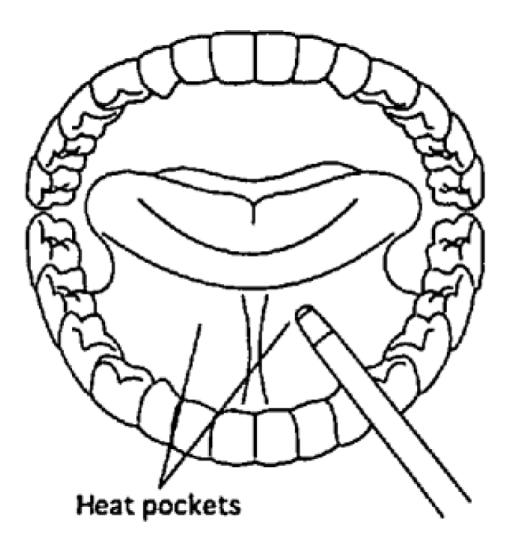 correspondiente también iluminada (es decir, orientada hacia la boca en el lado derecho de la cabeza, para tomar la temperatura oral).