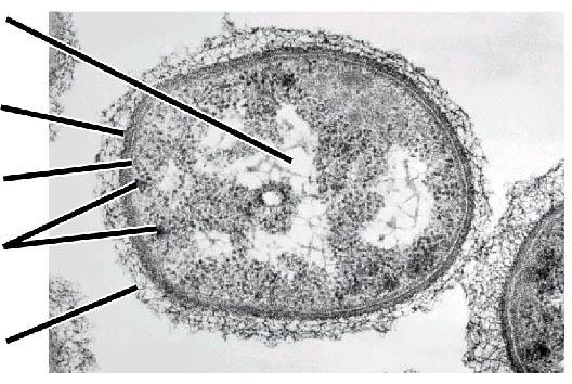 Cromosoma (región nucleoide) Pared celular
