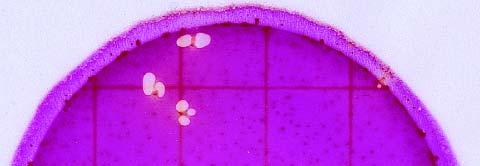 Las bacterias productoras de ácido se ven como colonias rojas rodeadas por una zona amarilla asociada con la producción de ácido que es detectado por el