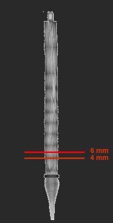 Profundidad de Implantación Deseable 4-6 mm -Debido al perfil de la válvula y la interacción con