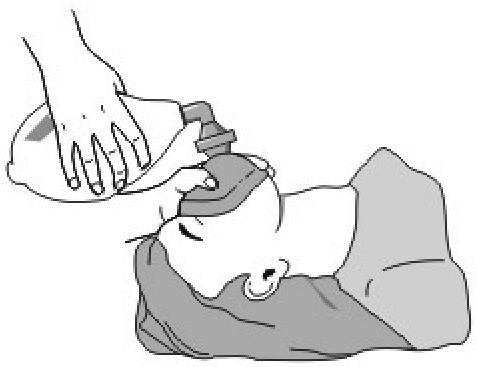 paciente pueda respirar sin dificultad. 2. Eliminar todos los órganos externos de la boca y la garganta. 3.
