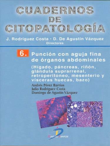 Cuadernos de Citopatología - 6 PUNCIÓN CON AGUJA FINA DE ÓRGANOS ABDOMINALES: hígado, páncreas, riñón, glándula