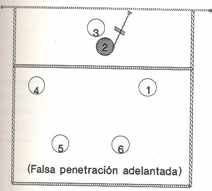 Figura 5.- Falsa penetración adelantada Figura 6.- Penetración retrasada. Figura 7.- Falsa penetración Figura 8.