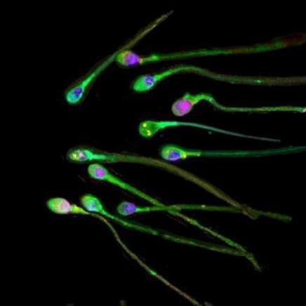 nucleicos en la esperma de peces.