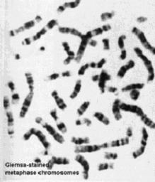El ADN se organiza en cromosomas. Los cromosomas contienen genes.