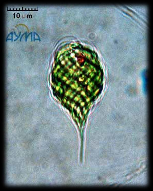 Almacenamiento de lípidos En las micro-algas al igual que en otros microorganismos en ausencia de algunos nutrientes como el nitrógeno, o ante la imposibilidad de realizar fotosíntesis a falta de