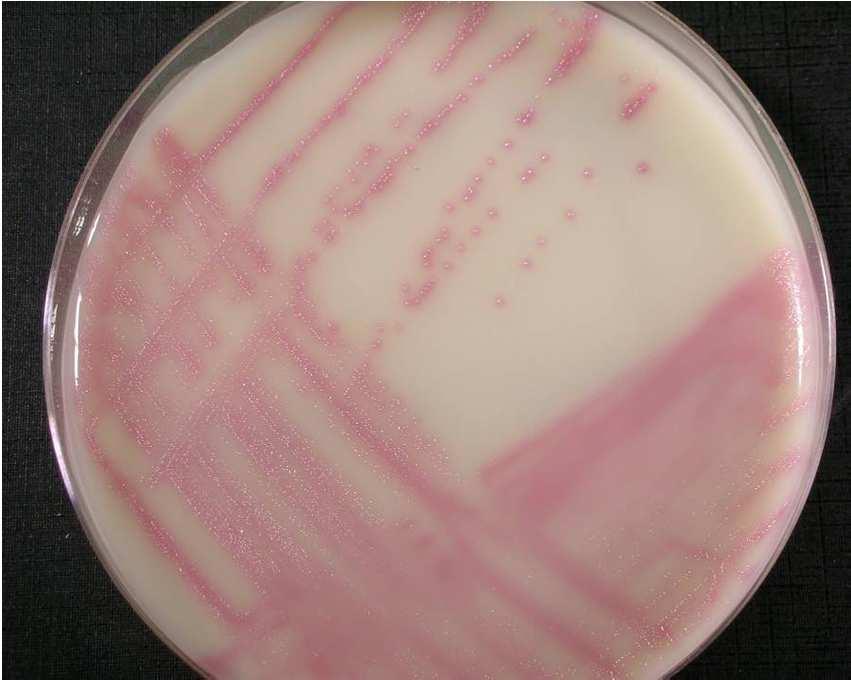 Placas selectivas: placas cromogénicas con antibiótico