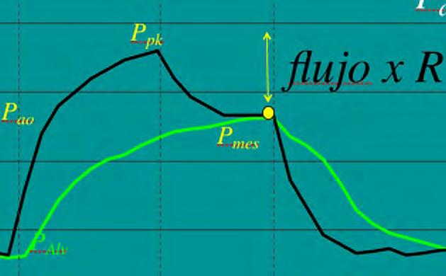 Pao = V x R + Vt x E+ PEEP Ppk 30 Presión (cmh2o) 20 Pao flujo x Pmes Pao mes= V xr + Vt x E+ PEEP xr P P = Flujo ao pk ao mes R R