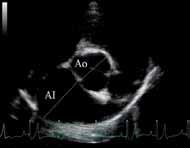 Vol. 30, nº3, 2010 L Figura 1. Radiografía lateral derecha de tórax.