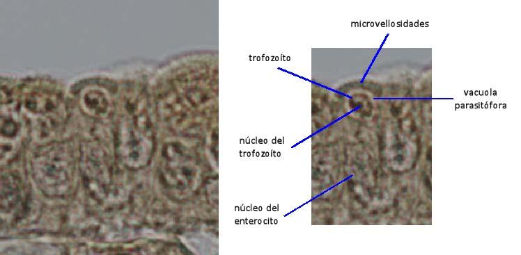 Trofozoíto (Fig. 6) Esquizonte (Fig.