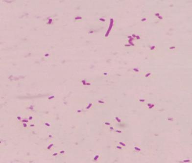 , Legionella spp., Campylobacter spp., Helicobacter spp., etc. Figura 22.