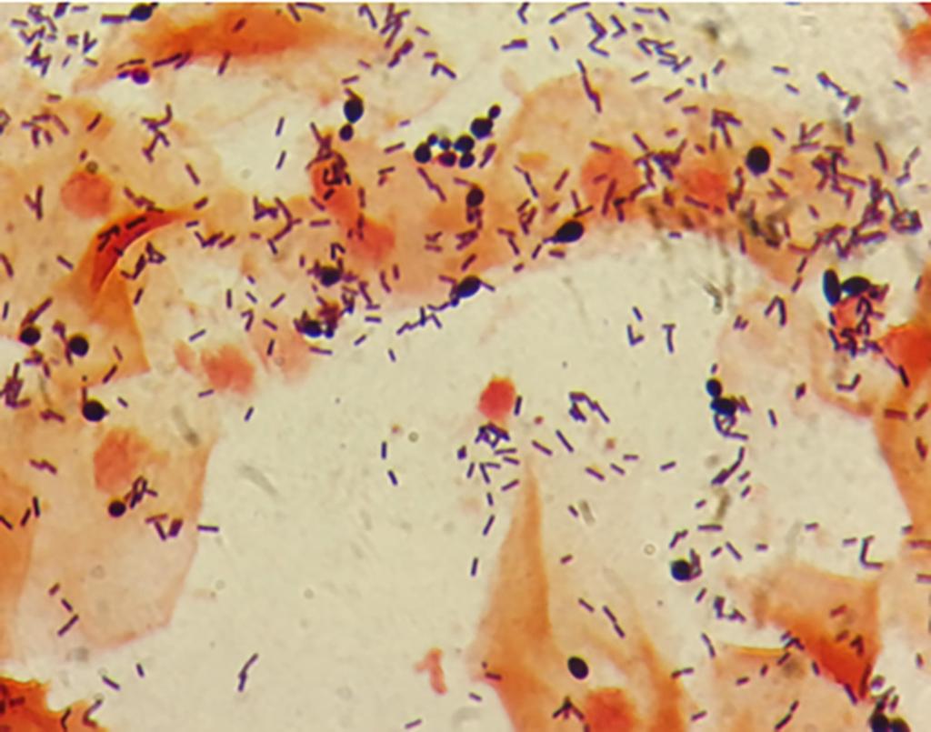 Aplicación de técnicas de tinción y observación de microorganismos 53 EJERCICIOS E1. Busca en Internet una imagen de tinción negativa de Cryptococcus neoformans. Puedes observar su cápsula?