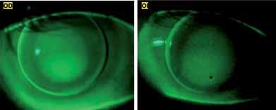 ÓPTICA OFTÁLMICA es muy bueno, aunque la lente del ojo izquierdo tiene cierta tendencia a descolgarse, pero sube bien si el parpadeo es completo. Figura 4.