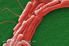 CONSIDERACIONES EN EFICIENCIA ENERGETICA Desarrollo de Legionella en instalaciones La Legionella pneumophila es una bacteria propia de la naturaleza que se encuentra generalmente y con mucha