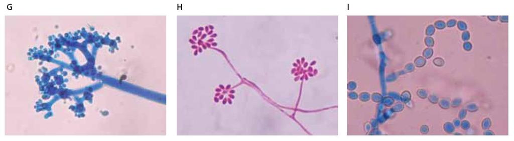 Imagen 2-11 G. Origen blástico-sincrónica: Botrytis cinerea. H.