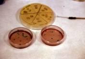 Los nuevos indicadores de contaminación fecal que se analizan corresponden a los siguientes microorganismos: Escherichia coli (E coli) y Enterococos intestinales (EI).